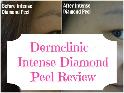 Dermclinic Intense Diamond Peel Review